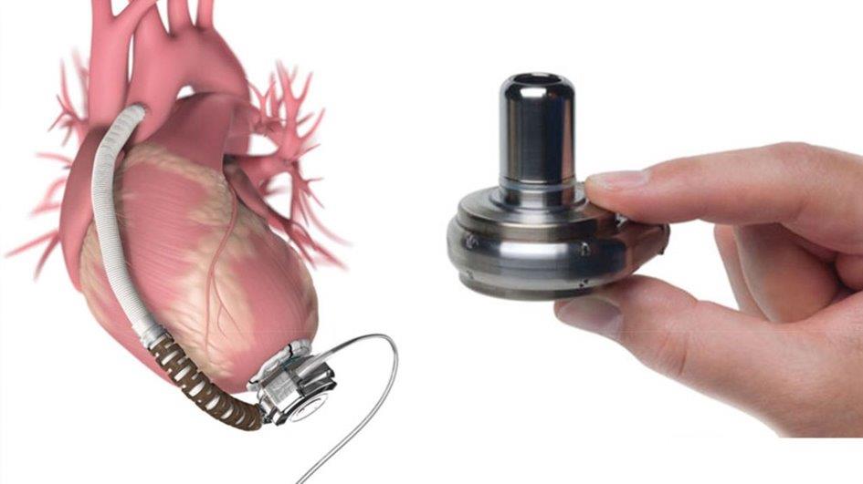 Mirmex Motor | Ventricular Assist Device Mirmex Motor | Ventricular Assist Device