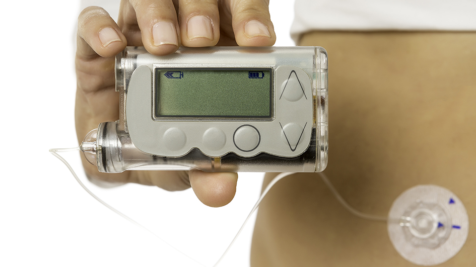 Mirmex Motor | Insulin Pumps Mirmex Motor | Insulin Pumps