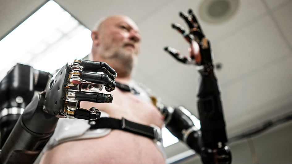 Mirmex Motor | Arm Prosthetics Mirmex Motor | Arm Prosthetics